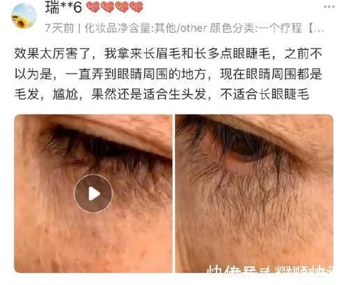 寸止挑战在 寸止挑战我用了这个办法后海报